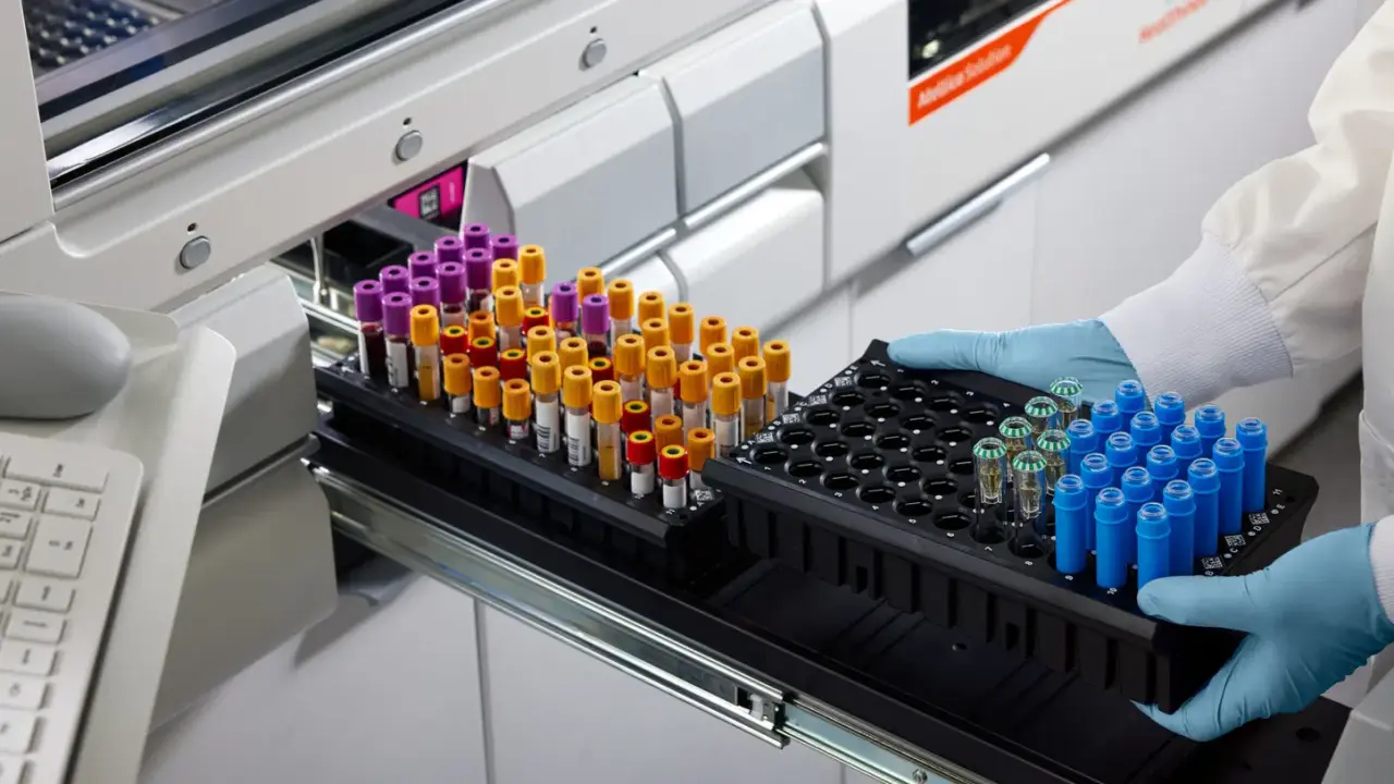 تصویر مرتبط با خبر: Siemens Healthineers bietet branchenführendes Menü für Kapillarbluttests im Zentrallabor auf Atellica Analysesystemen mit Zulassungen für 24 Assays