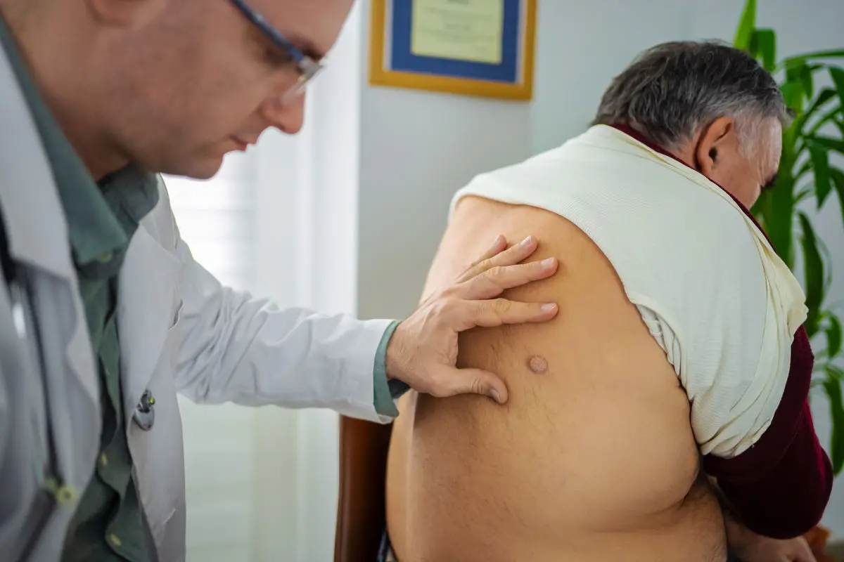 تصویر مرتبط با خبر: 圧迫された腫瘍の成長がなぜ遅くなるのかをAIが解明